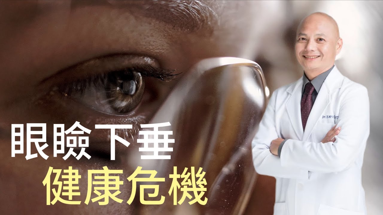 眼瞼下垂可能是因神經受到壓迫❗️交感神經、動眼神經受壓迫的影響｜長期眼瞼下垂竟會造成腦部退化？
