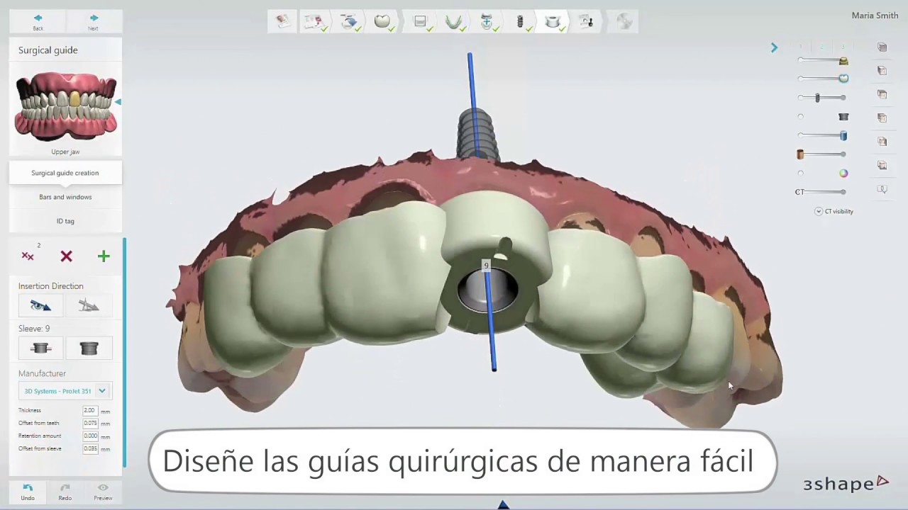 Implant Studio - Implantology the digital way by 3Shape - Spanish