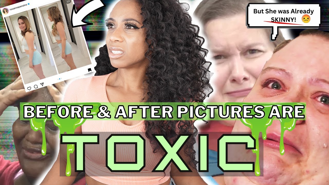STOP POSTING BEFORE AND AFTER PICTURES