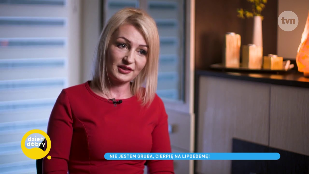 Choroba grubych n&oacute;g. Czym jest lipoedema. Dzień dobry TVN.