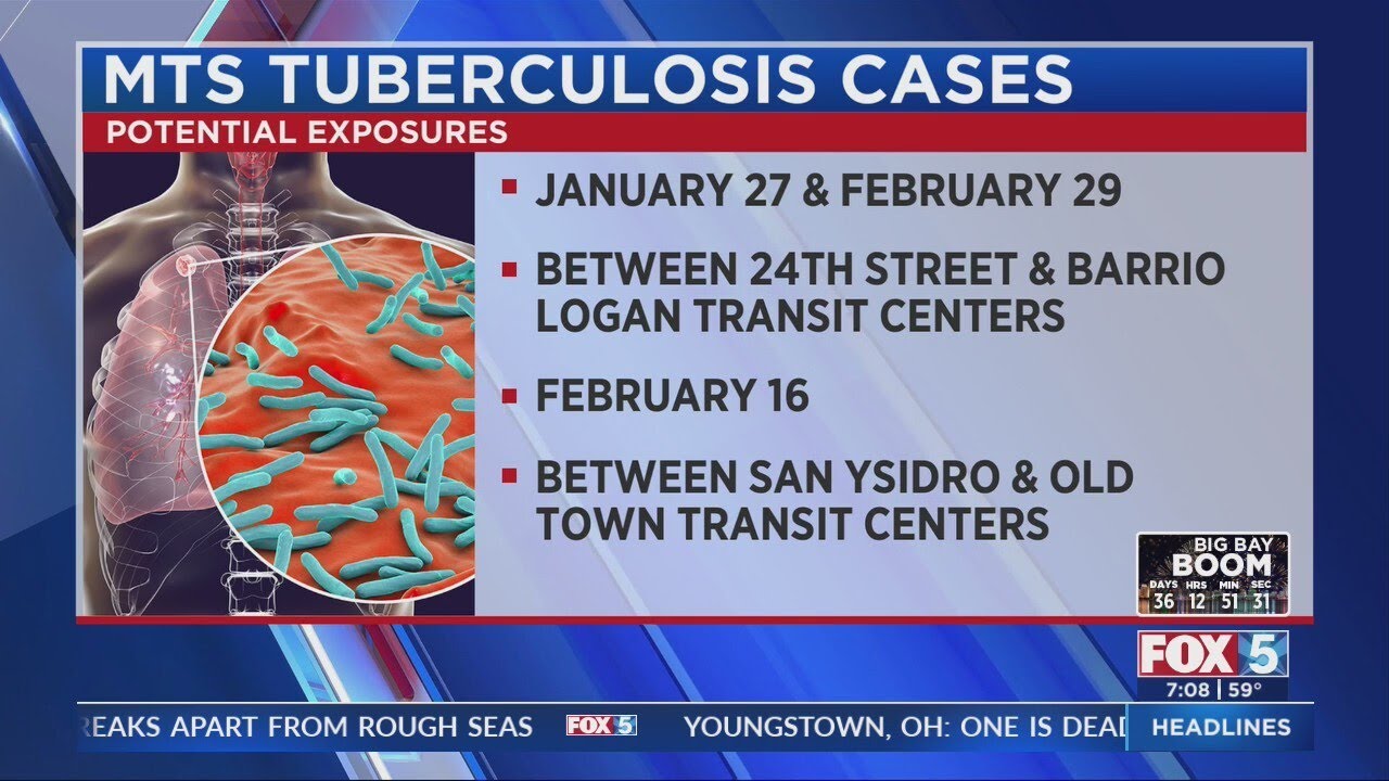 Tuberculosis exposure reported on MTS Trolley Blue Line