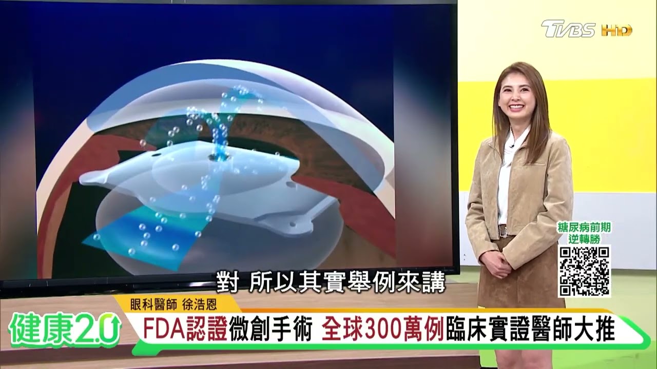 近視、老花、散光一次解決？！第四次視力革命EVOICL新型植入式隱形眼鏡！健康2.0