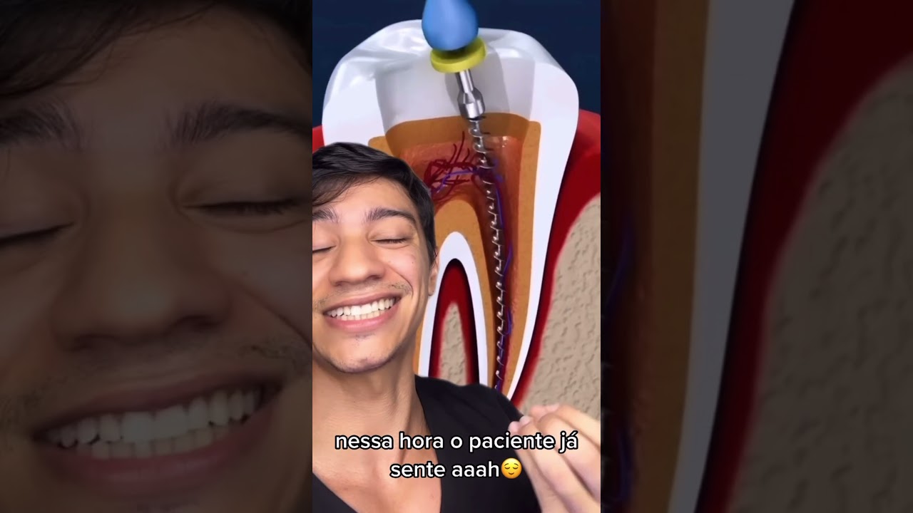 Canal no dente. ASSIM que &eacute; feito !! #shorts