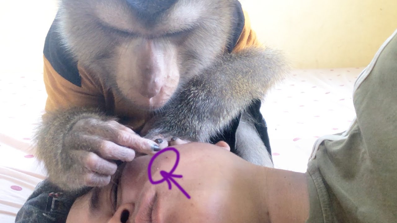 Jason Appreciate Grooming To Draw Out Blackhead Acne On Cheek