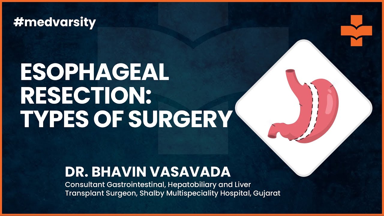 Esophageal Resection & Types of Surgery | @MedvarsityTechnologiesPvtLtd