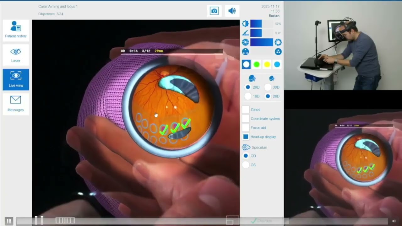 Eyesi ROP Laser Release Webinar