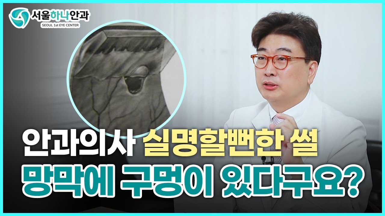 안과의사도 시력을 잃을 수도 있는 무서운 망막열공에 대해서 자세히 알려드립니다.