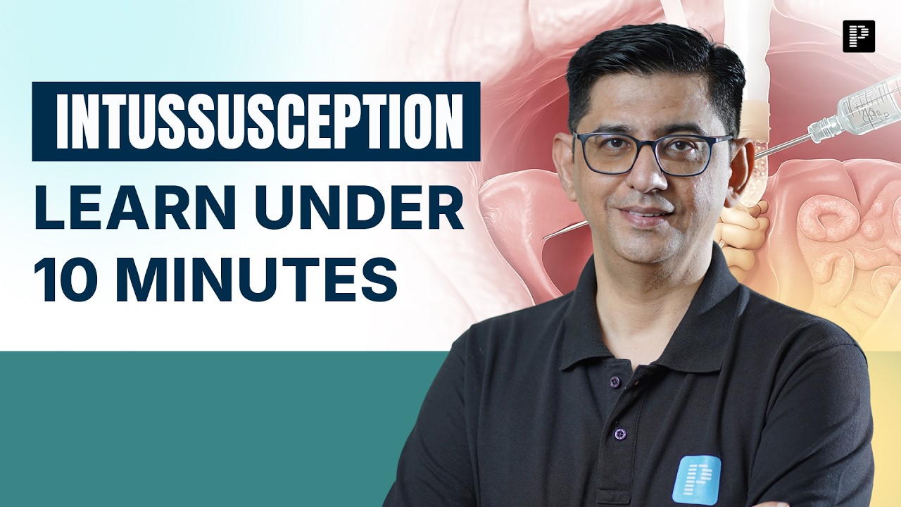 Learn Intussusception Under 10 Minutes | Dr. Marwah Speaks!!
