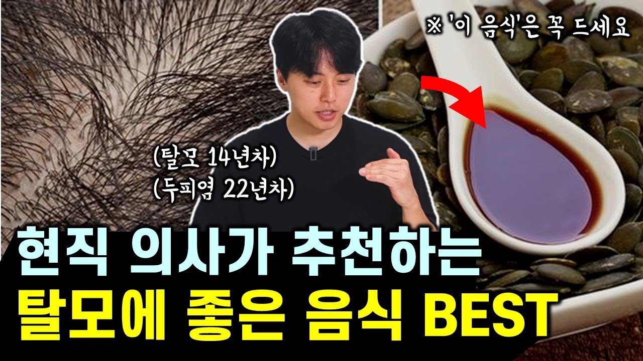 정수리 탈모, 여성 탈모에 효과 좋은 추천 음식 5가지 (feat. 논문 근거)