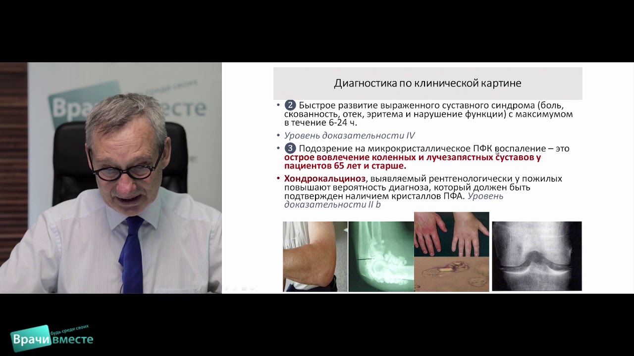 Вебинар «Микрокристаллические артриты:  дифференциальная диагностика и рекомендации по лечению»