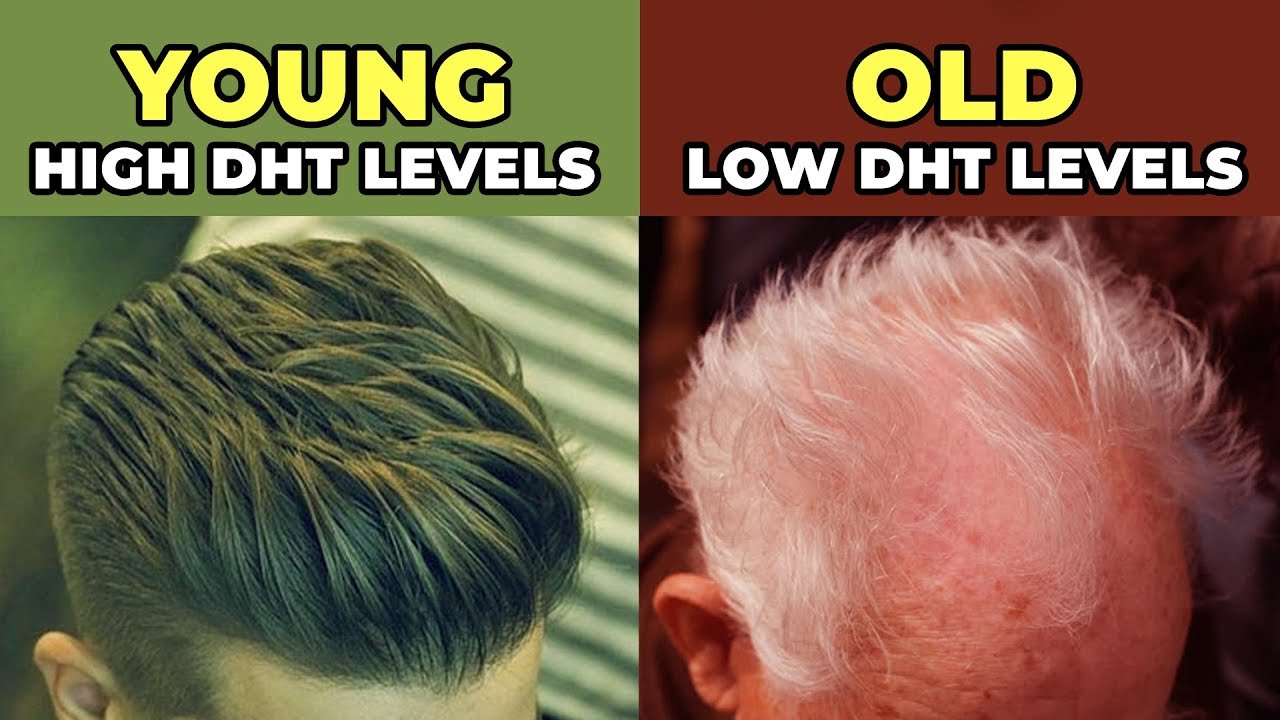 You DO NOT Produce More DHT As You Get Older - Why Old Men Lose Hair Faster Than Young Men