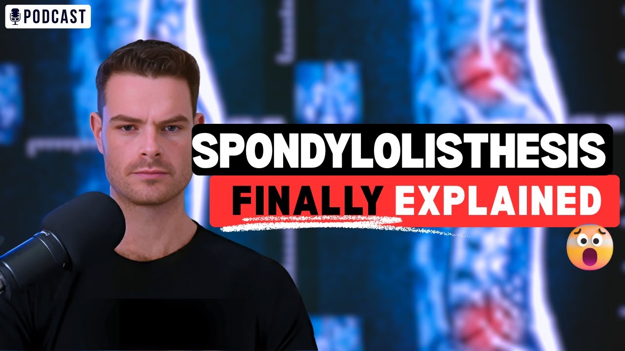 Spondylolisthesis Explained: Symptoms, Science and Solutions!