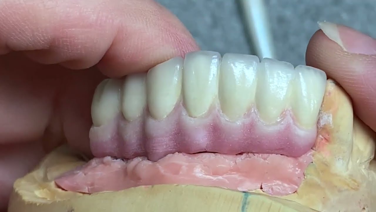 How To Apply Pink Porcelain to Lower Front Bridge