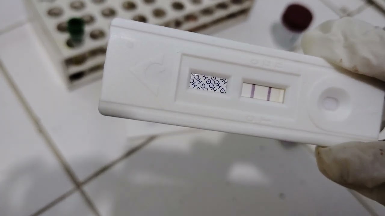 كيفية عمل فحص الحمل من الدم والبول بطريقة سهلة How to work pregnancy test from blood and urine
