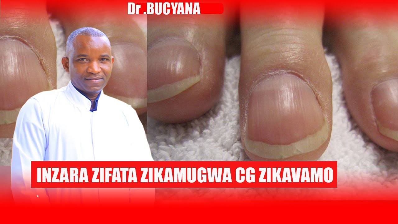 INZARA ZIFATA ZIKAMUNGWA CG ZIKAVAMO.DORE ICYO BISOBANUYE KU BUZIMA BWAWE.