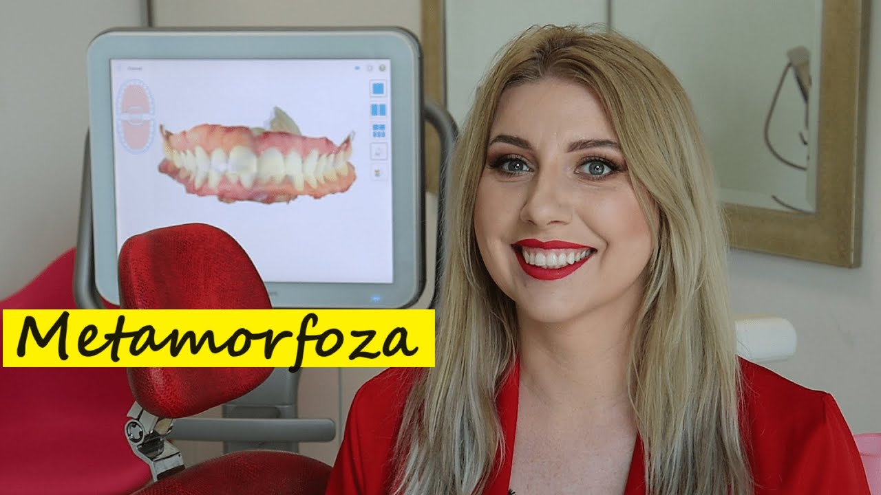 Metamorfoza mojego uśmiechu z Dentalcare.