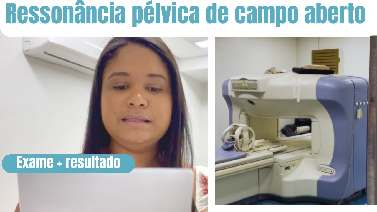 RESSONÂNCIA PÉLVICA | TENHO ENDOMETRIOSE ?