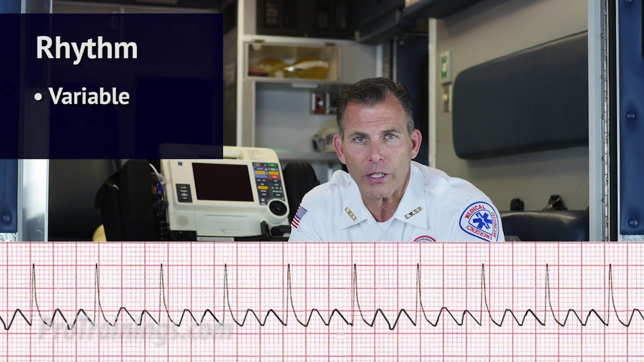 Atrial Flutter (ECG Rhythm Interpretation)