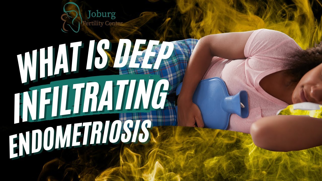 WHAT IS DEEP INFILTRATING ENDOMETRIOSIS?