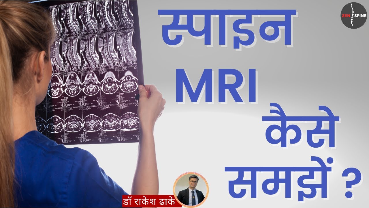 स्वयं स्पाइन MRI समझें: एक आसान मार्गदर्शिका (Reading Your Spine MRI: Hindi)