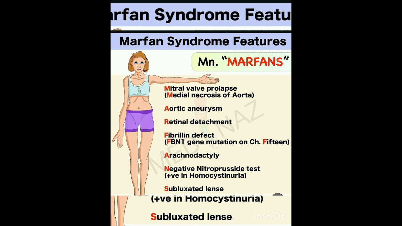 #marfansyndrome