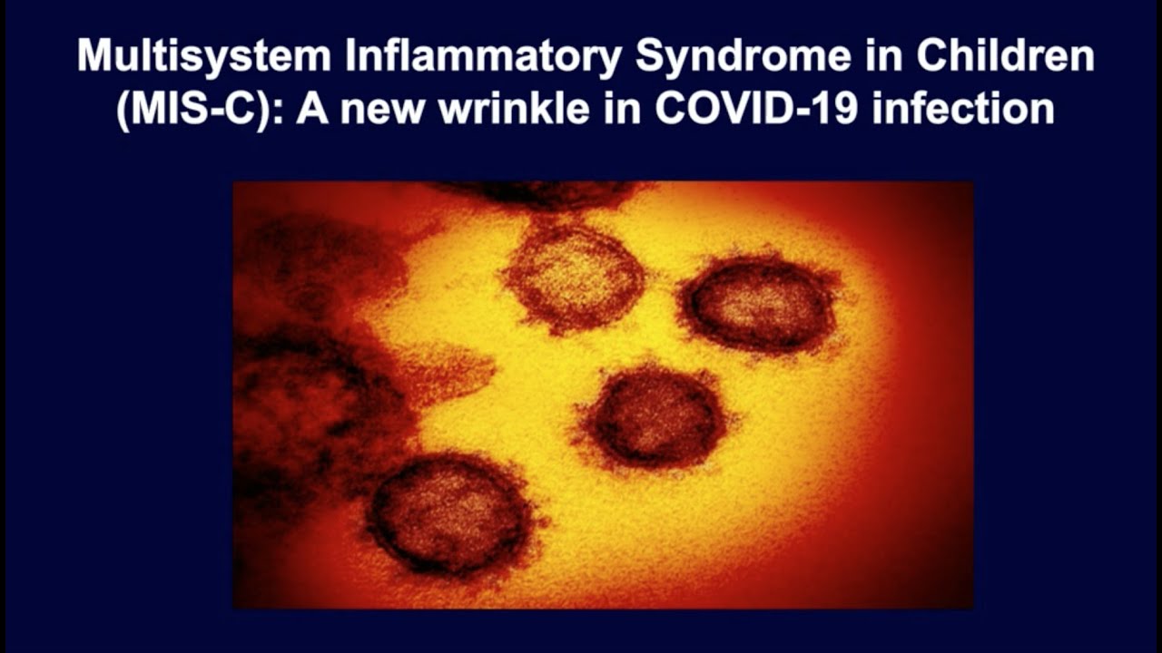 Multisystem inflammatory syndrome in children: A new wrinkle in COVID-19 infection