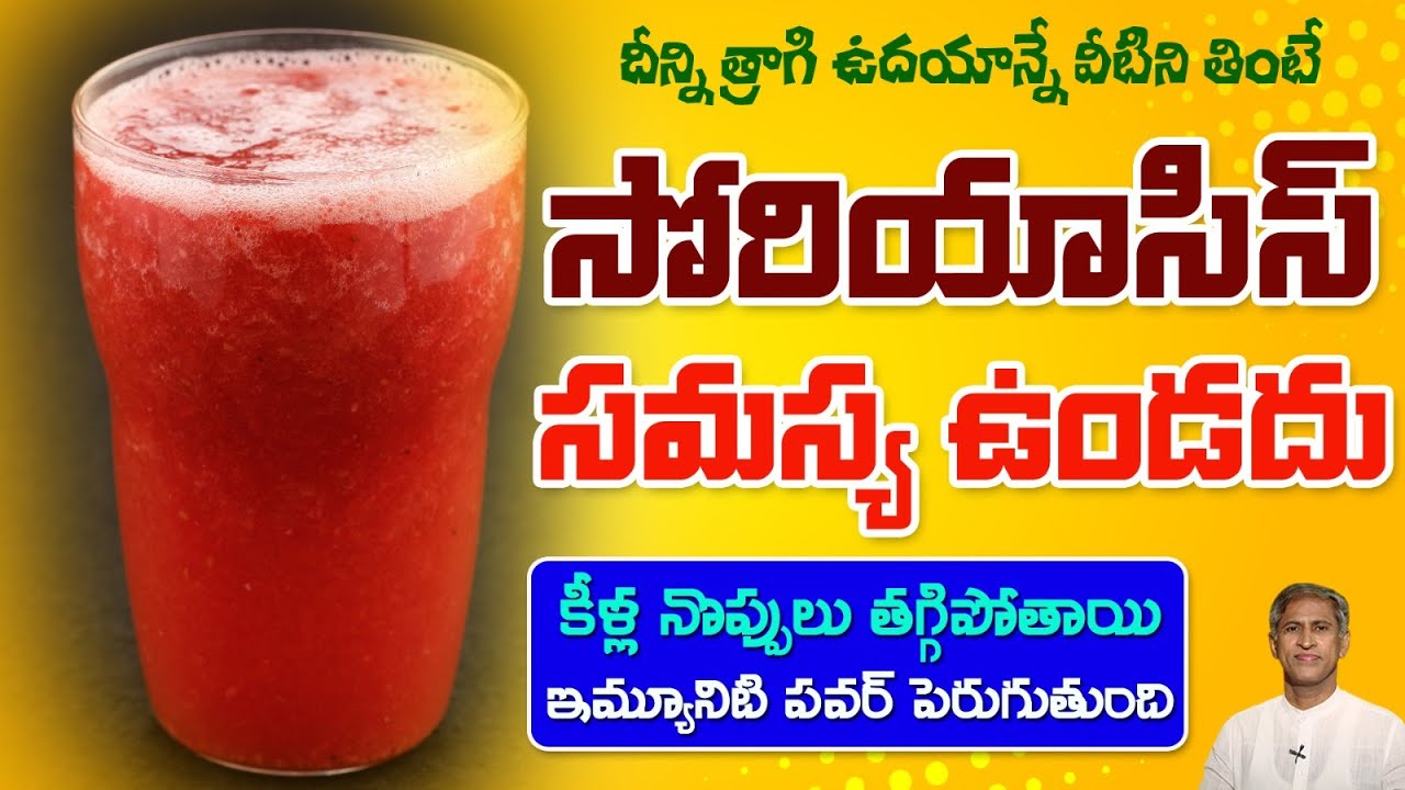 How to Prevent Psoriasis | Skin infection | Reduces Knee Pain | Natural Diet | Dr. Manthena Official
