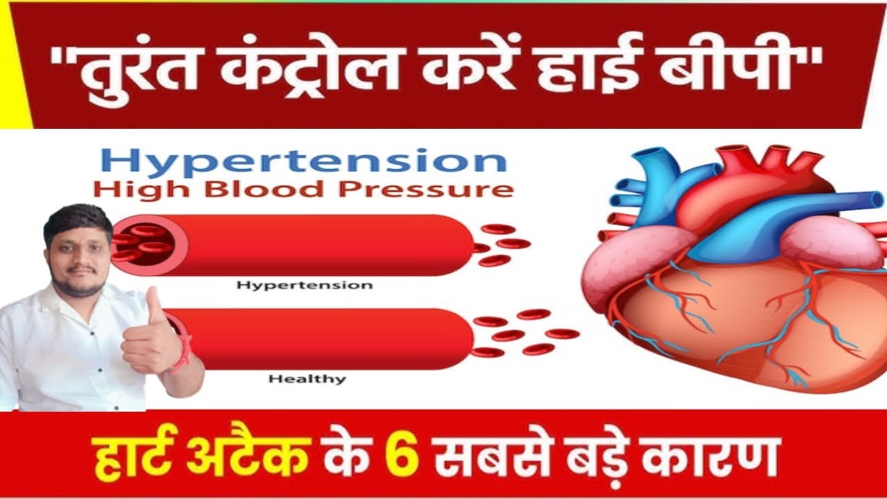 👉High Blood Pressure मे 𝗟𝗶𝗽𝗶𝗱 𝗣𝗿𝗼𝗳𝗶𝗹𝗲 ( कोलेस्ट्रॉल ), 𝗕𝗹𝗼𝗼𝗱 𝗦𝘂𝗴𝗮𝗿 और 𝗩𝗶𝘁𝗮𝗺𝗶𝗻𝗲 𝗧𝗲𝘀𝘁 क्यों है जरूरी |