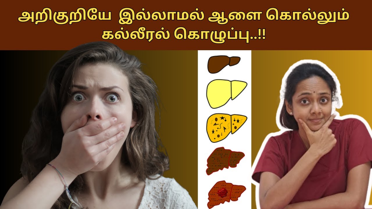 Fatty liver is a silent killer !