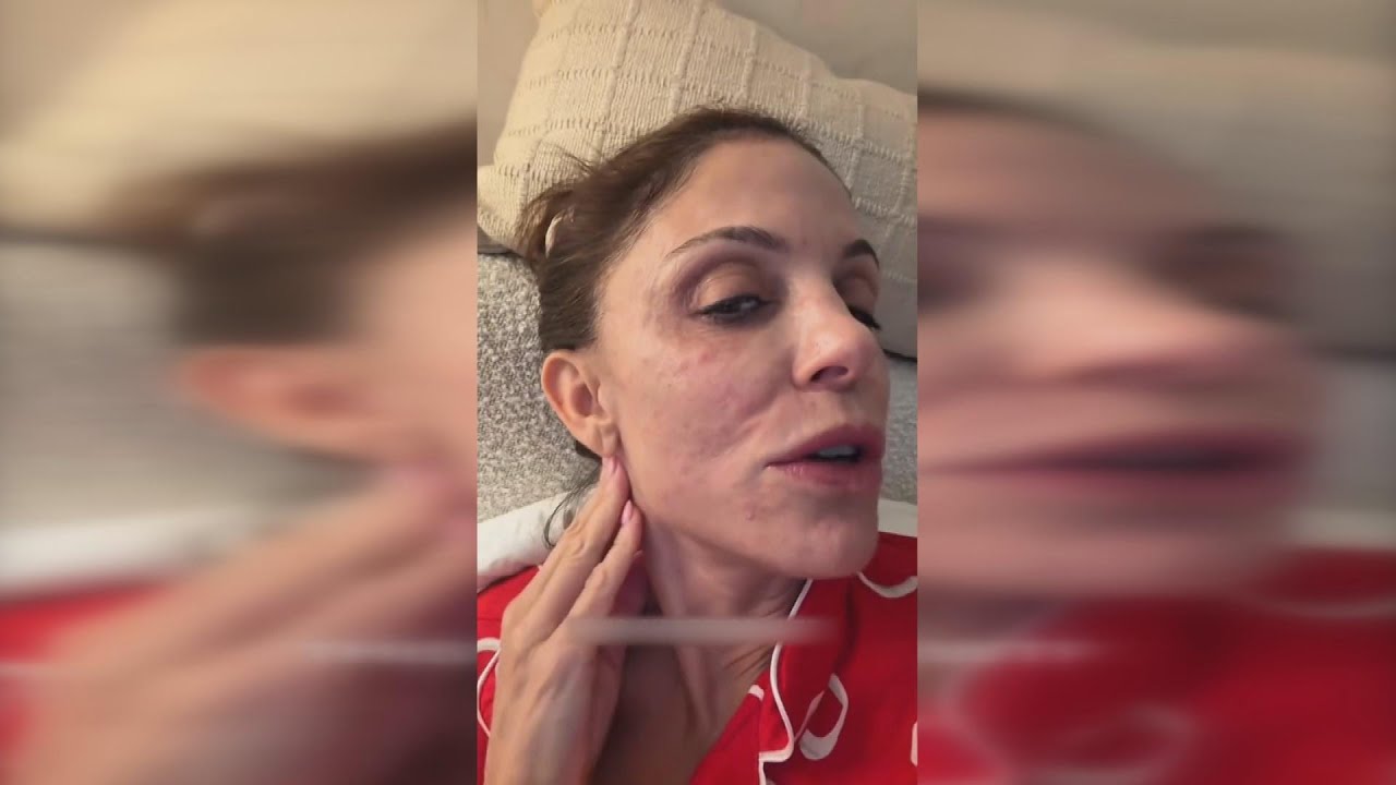 TV Star Bethenny Frankel Says She Got Rash From Dirty Hotel Sheets