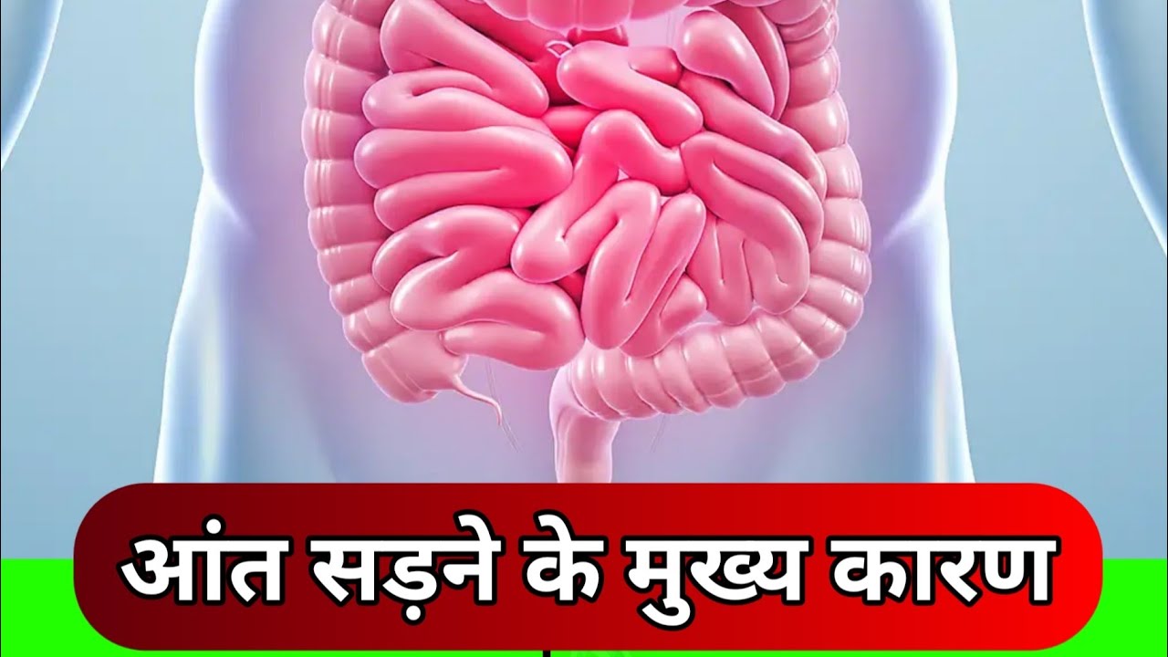 Gut Rotting Causes: आंत सड़ने के चौकाने वाले कारण #shorts #livestream #shortslive #live
