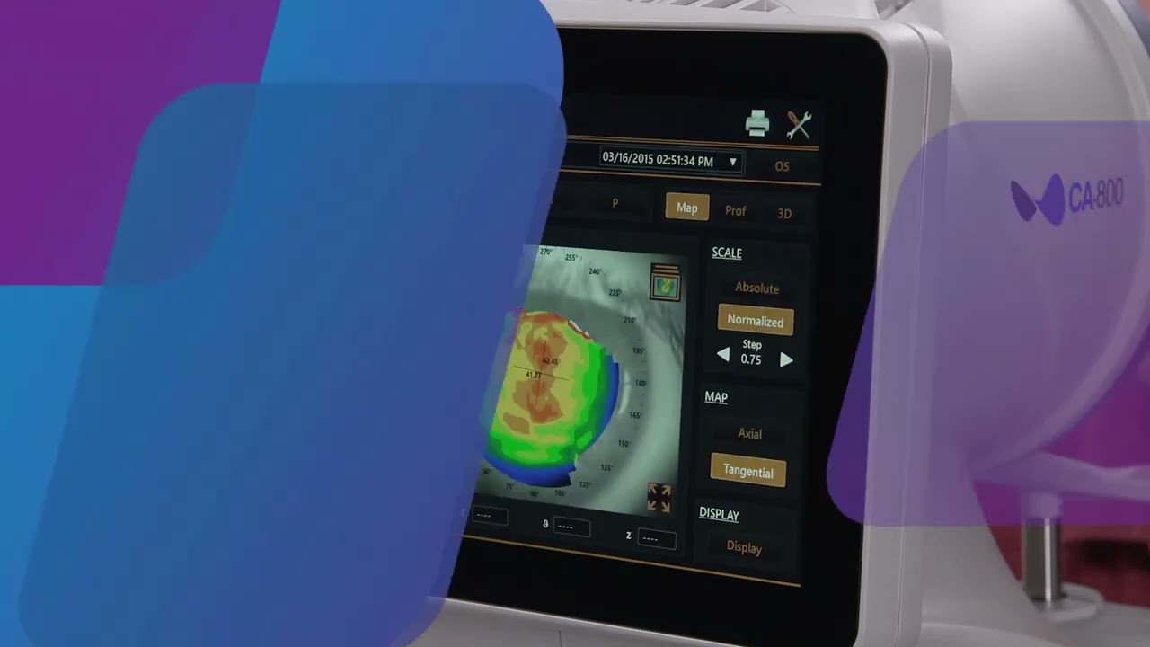 Topcon CA-800: Reviewing Corneal Topography Maps