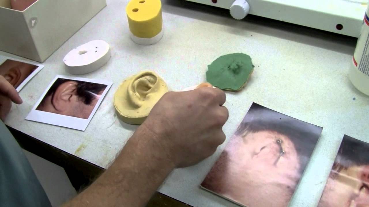 Prosthetic ears: how they're made