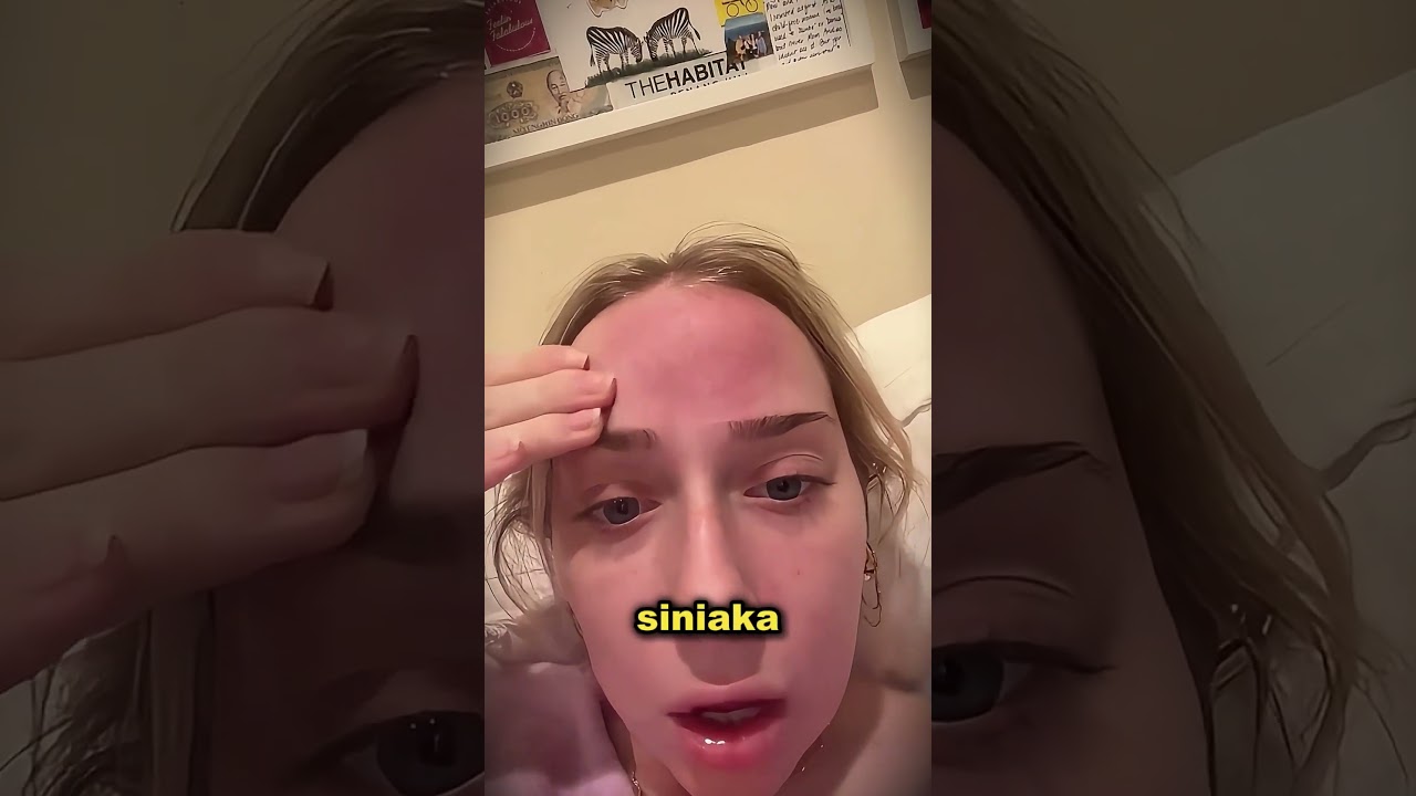 Postawiła Bańkę Na Swoim Czole... 👀