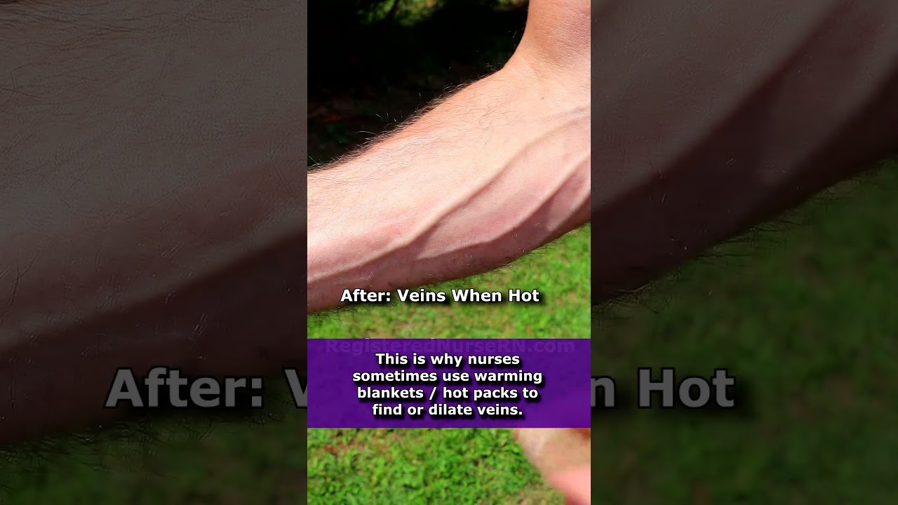 Veins Before and After (Popping Out) Getting Hot | Vasoconstriction vs Vasodilation