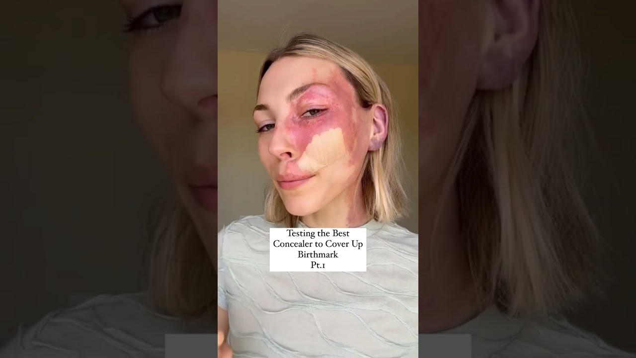 Testing Concealers on Birthmark pt.1