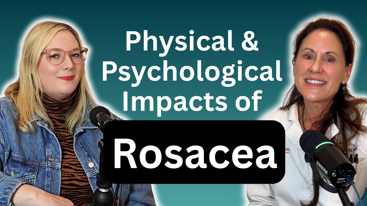 Rosacea: More Than Skin Deep