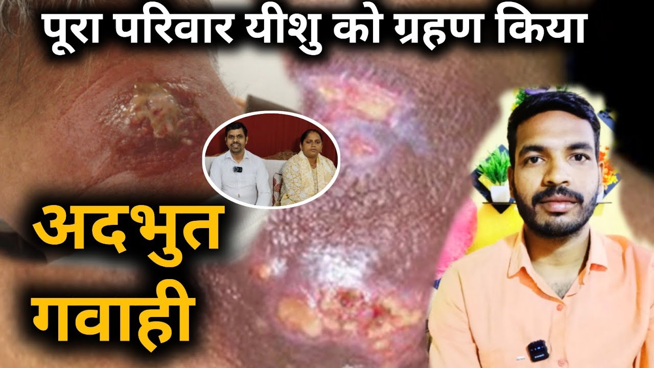 पूरा परिवार यीशु को ग्रहण किया - अदभुत गवाही - CHRISTIAN TESTIMONY दिल हिला दिया 