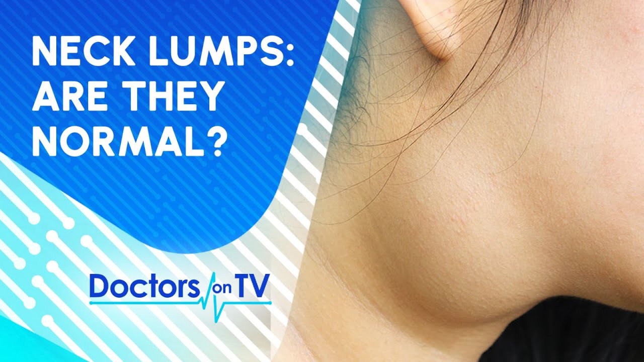 Is a Lump on Neck a Sign of Major Health Concern?