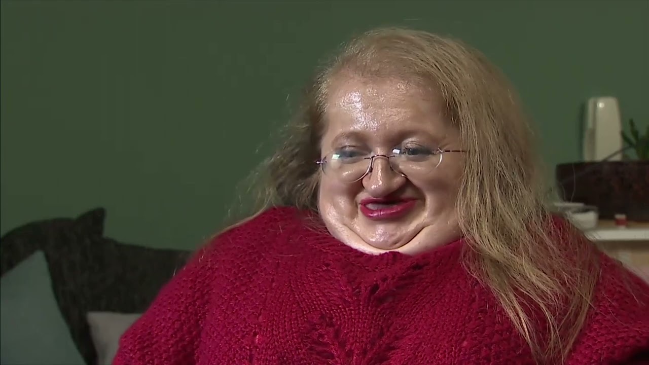 Disabled woman made 1,000 calls for Ed Sheeran tickets