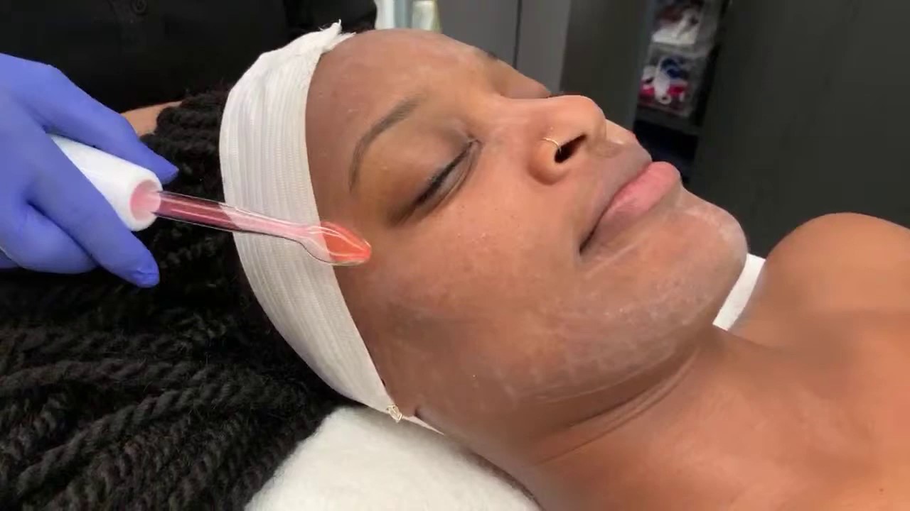 High-frequency device for Blemishes | West Hollywood, CA | Dr. Jason Emer
