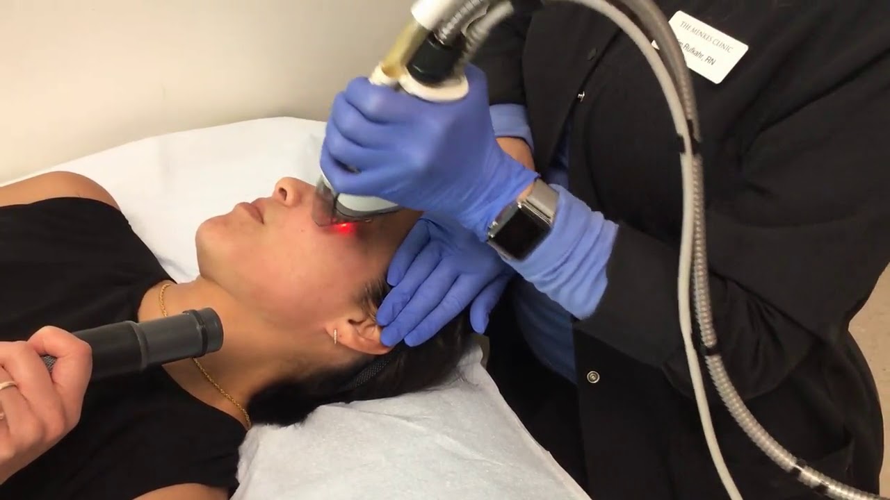Fraxel Dual At The Menkes Clinic