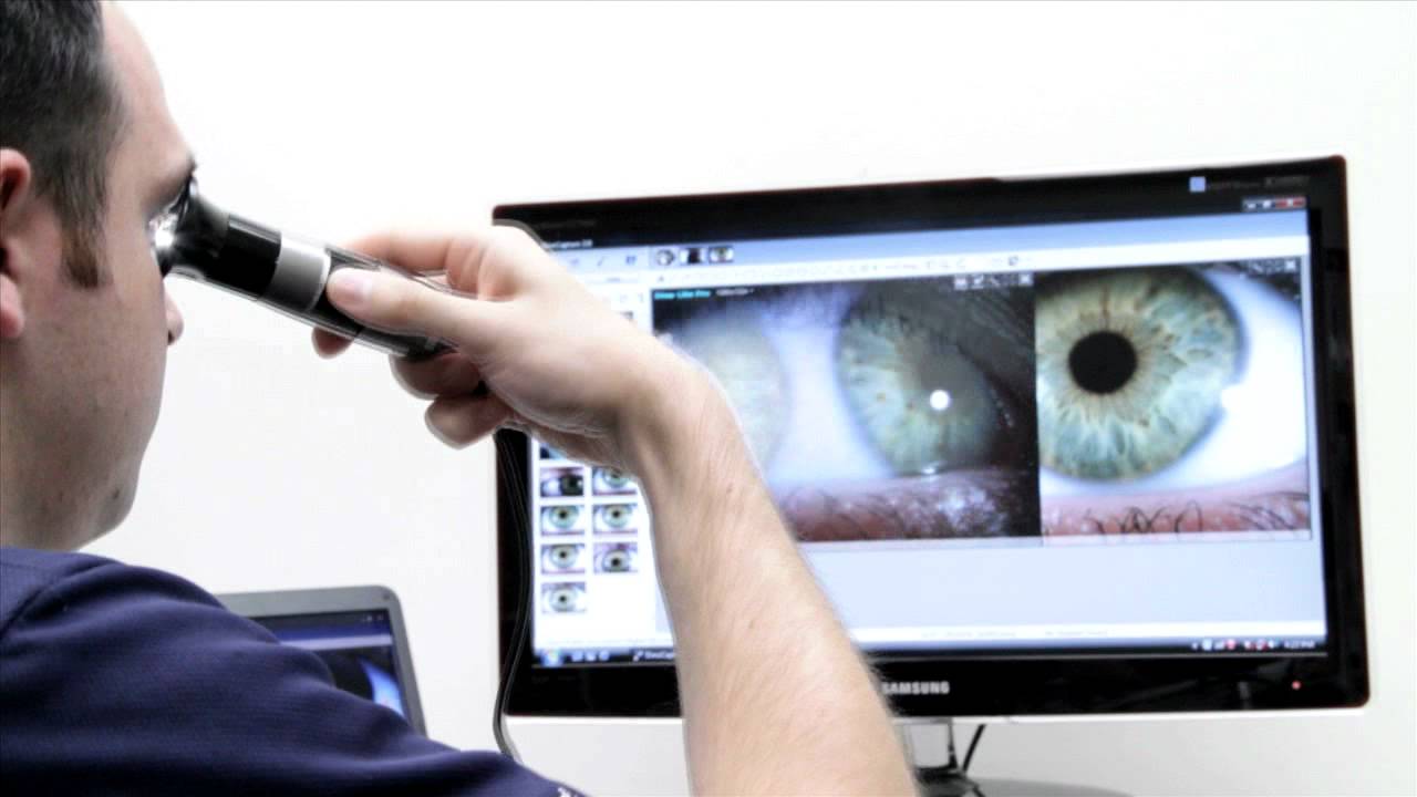 Dino-Lite AMH-RUT USB Iris Scope