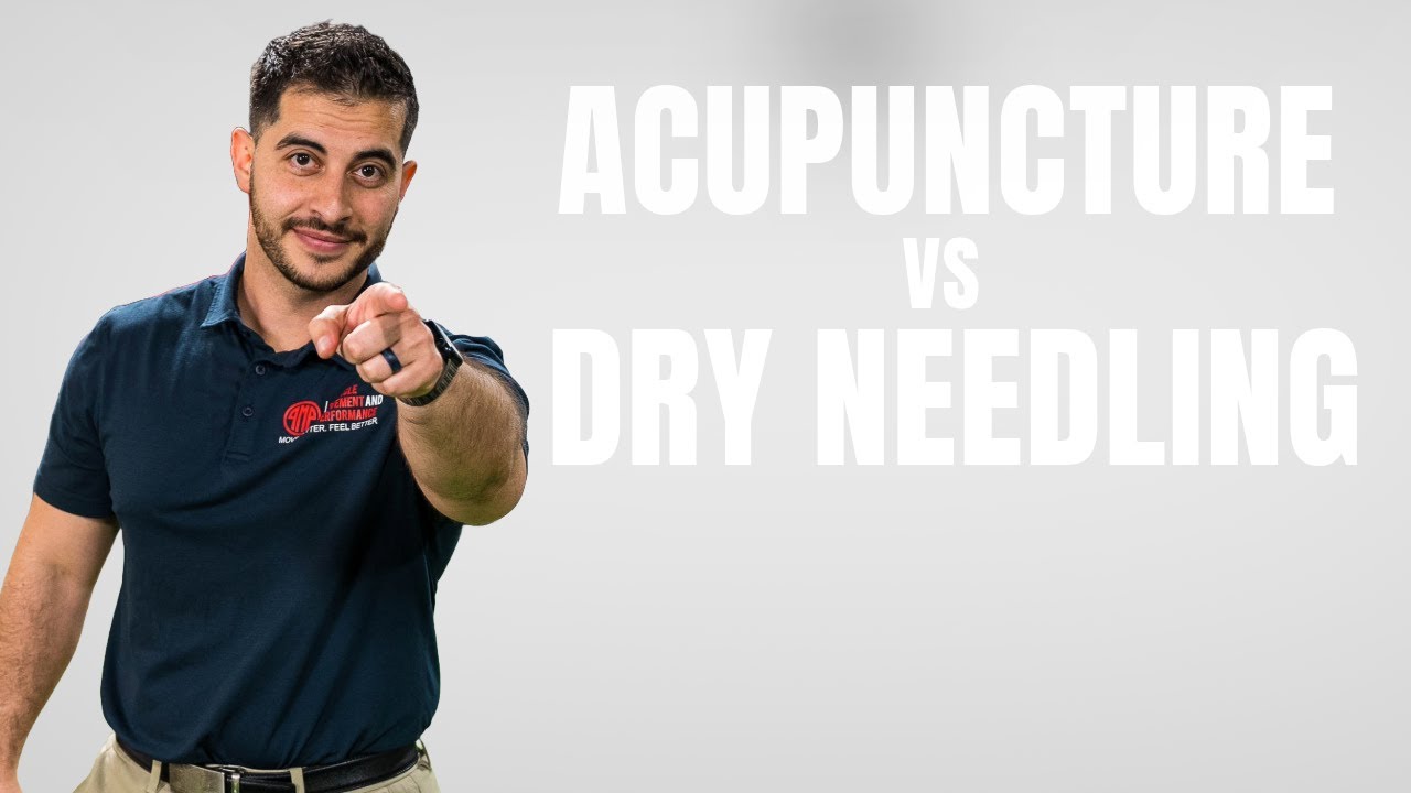 Dry Needling vs Acupuncture: What’s the Difference?