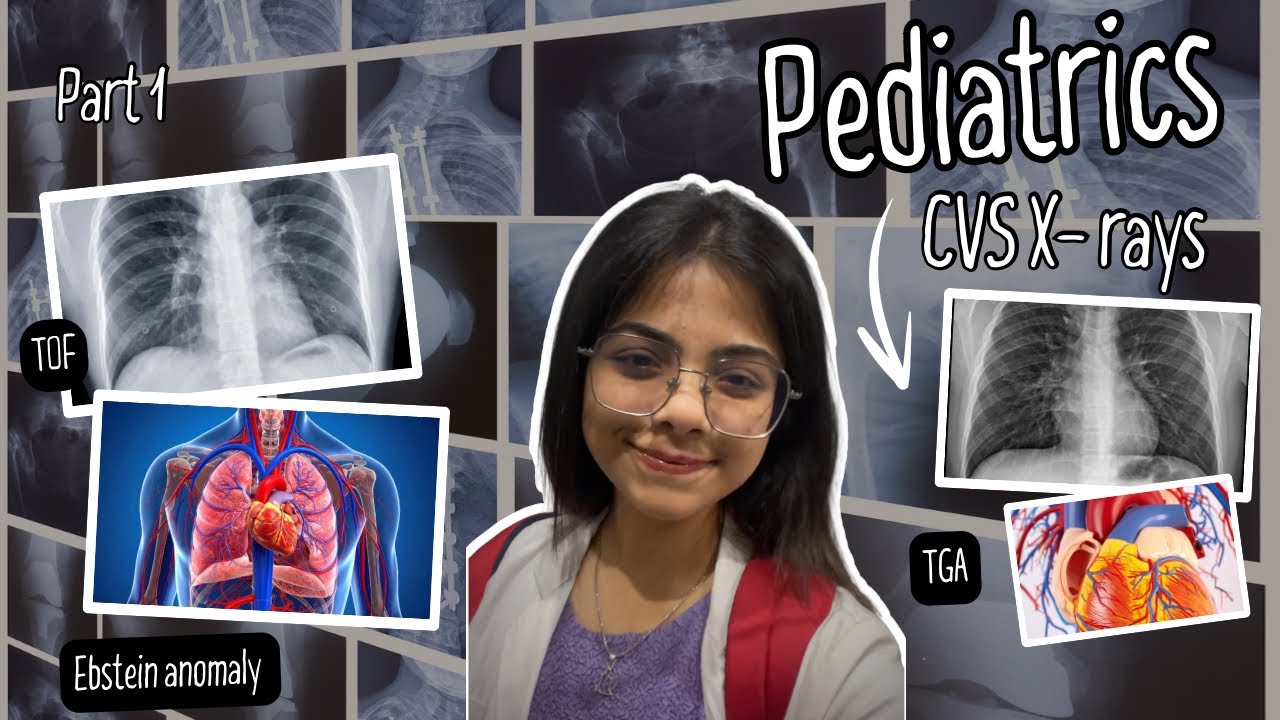 Must-Know Pediatric Cardiology X-Rays | Tricks That Help You NEVER Miss a Diagnosis  | PART 1 #mbbs