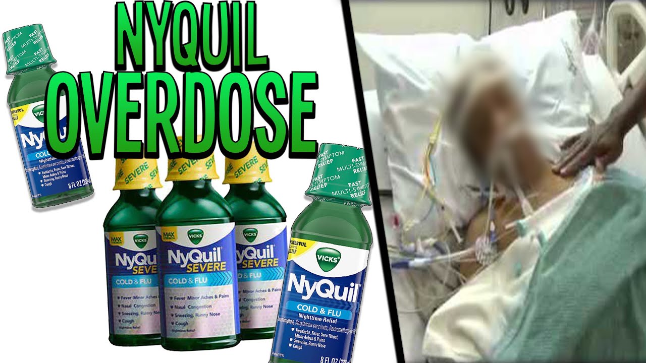 NyQuil Overdose