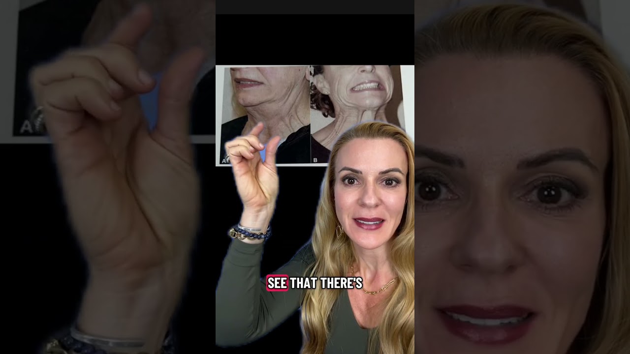 Neck Lift| Liposuction| Plastic Surgery| Houston, TX