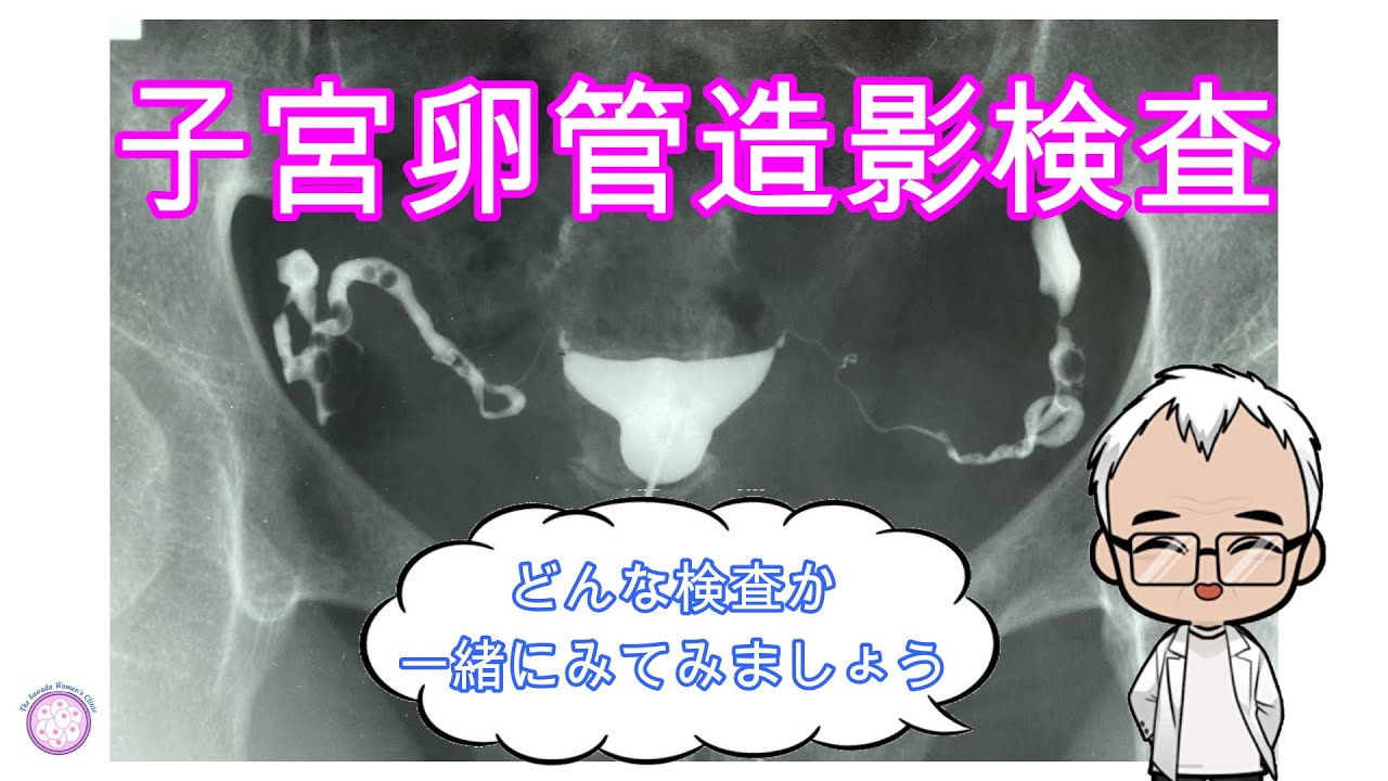 子宮卵管造影検査～不妊治療のひとこま～