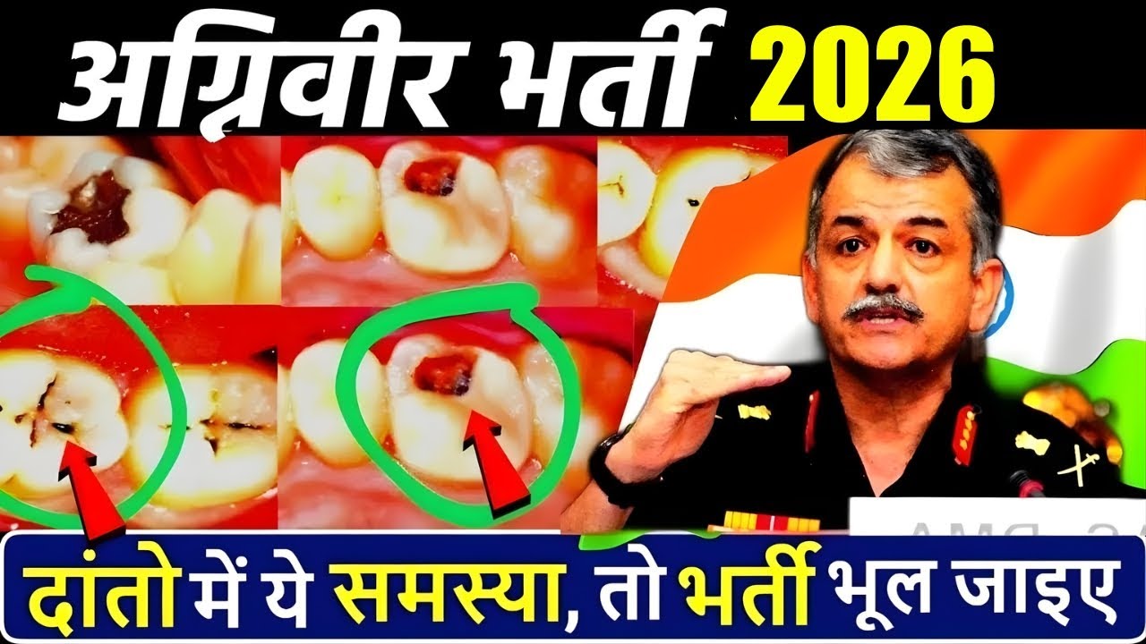 दांतो में ये समस्या है तो अग्निवीर भर्ती नहीं होगी ? Agneepath teeth medical test | Agniveer Medical