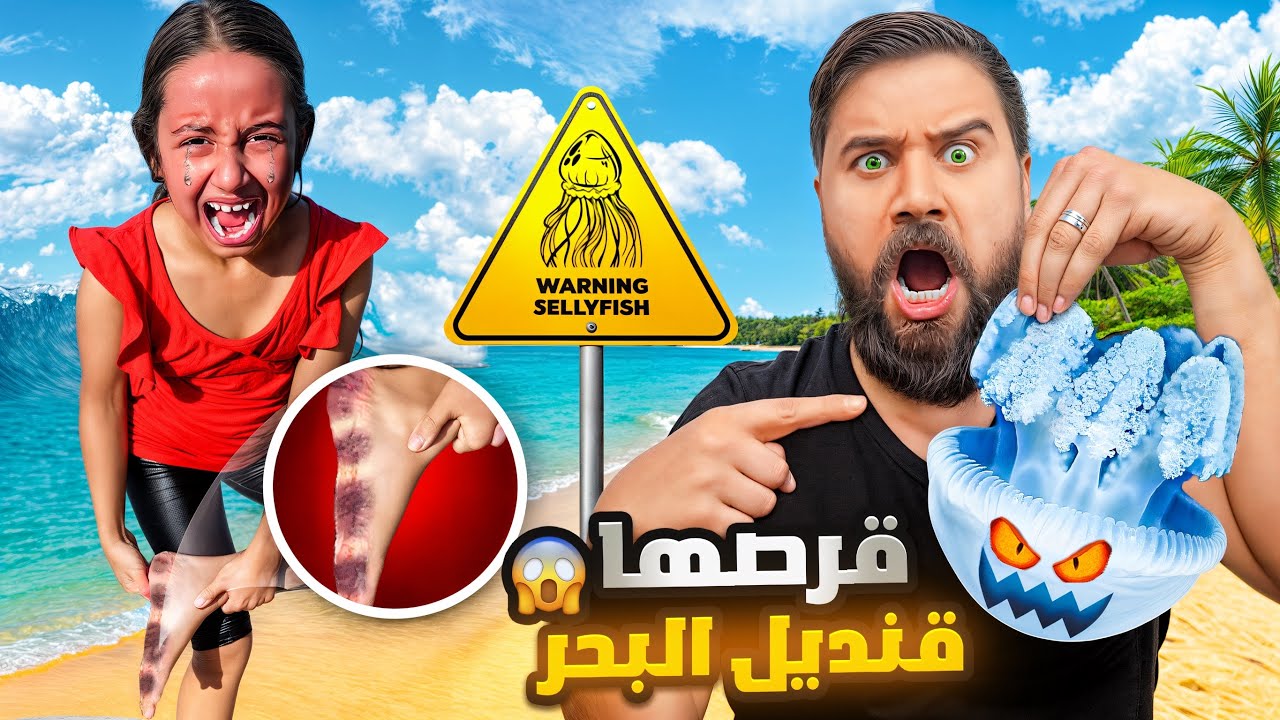 ميرا قرصها قنديل البحر🪼😱اخذناها عالمستشفى😭